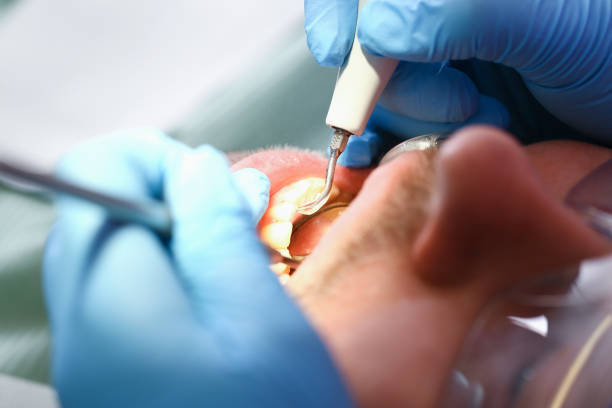 Best Emergency Dental Surgery in Amity Gardens, PA